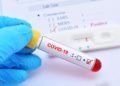 Covid-19: Ghana records 15,472 cases with 11,433 recoveries