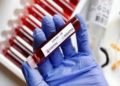 Ghana records 397 new Covid-19 case sending total case count to 12,590